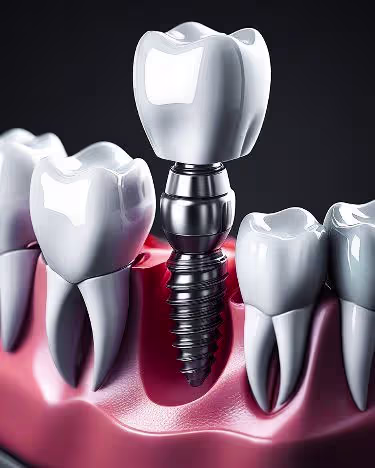 Shyam Dental team